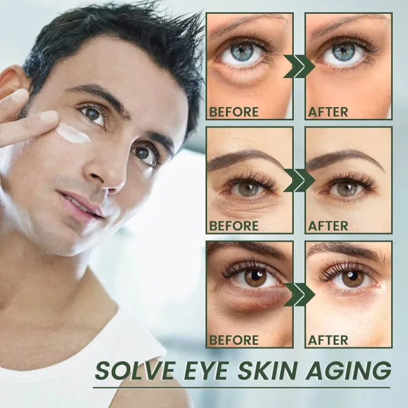 Anti aging eye cream firming anti-wrinkle lighten fine lines remove eye bags dark circles Puffiness Moisturizing eyes care